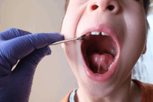 Dentist examining a child’s tongue tie